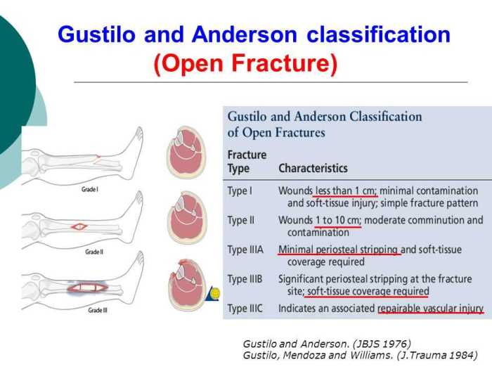 Activity 14 1 glass fracture patterns answer key